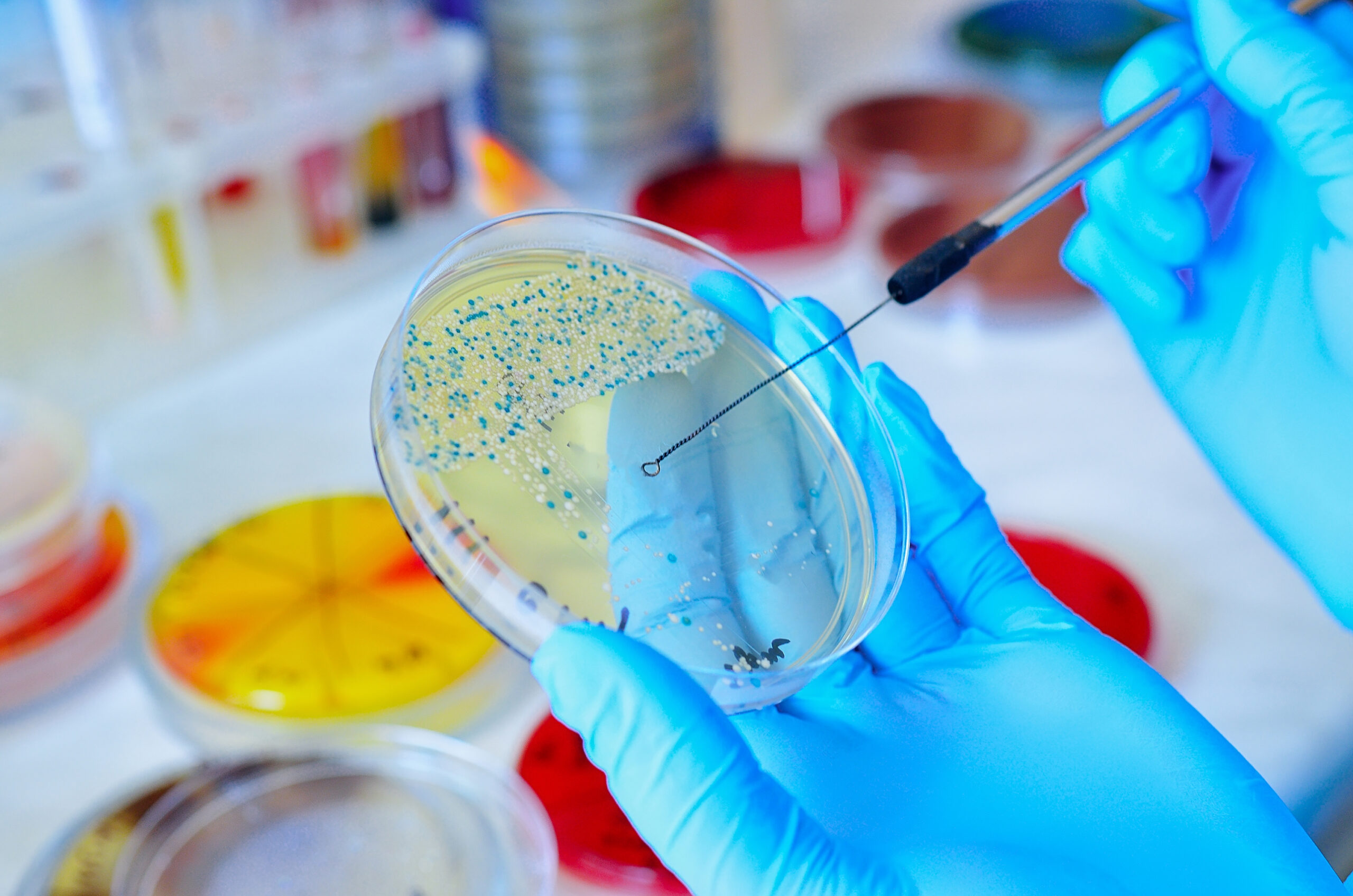 Petri,Dish.,Microbiological,Laboratory.,Mold,And,Fungal,Cultures.,Bacterial,Research